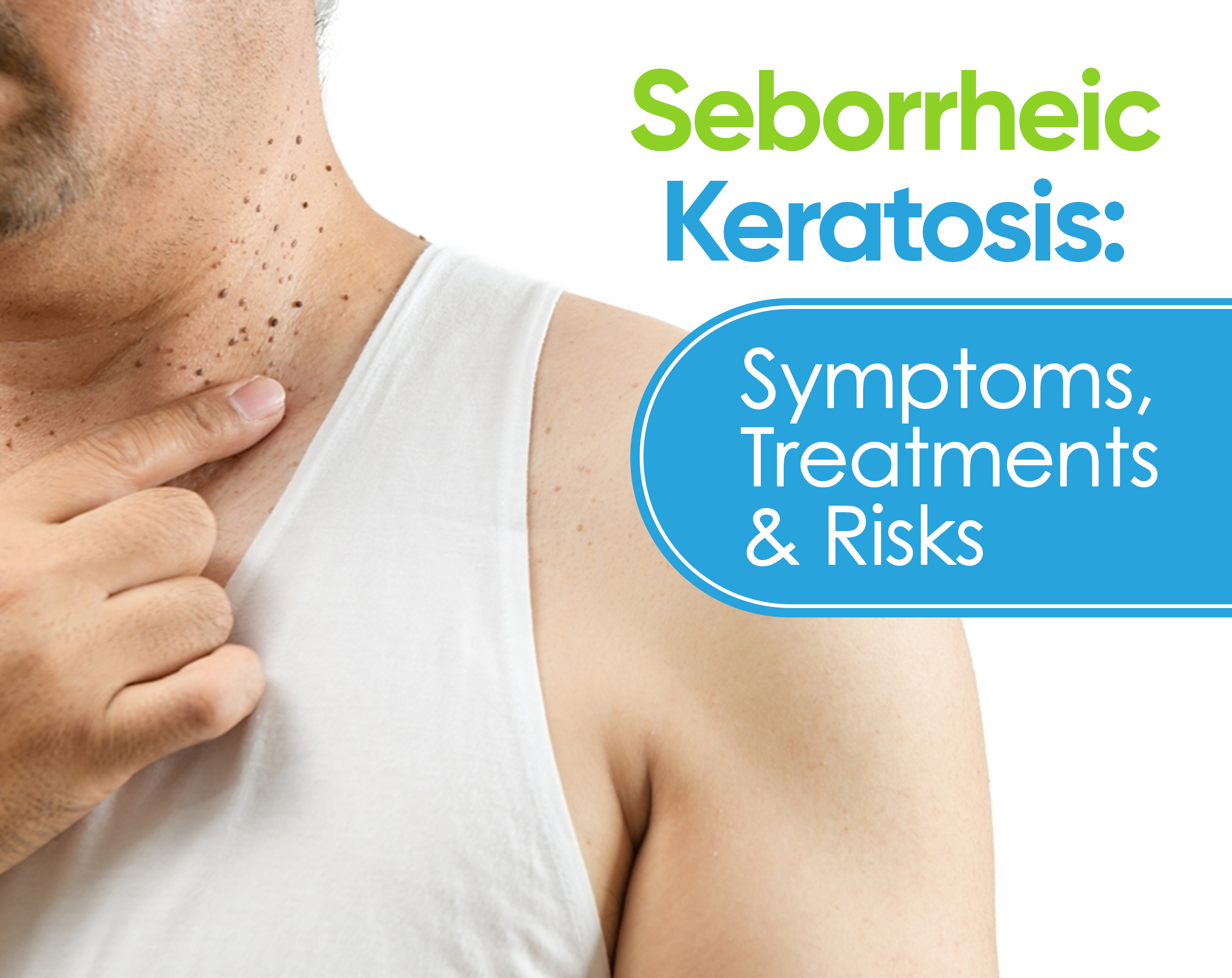 Seborrheic Keratosis: Symptoms, Treatments & Risks