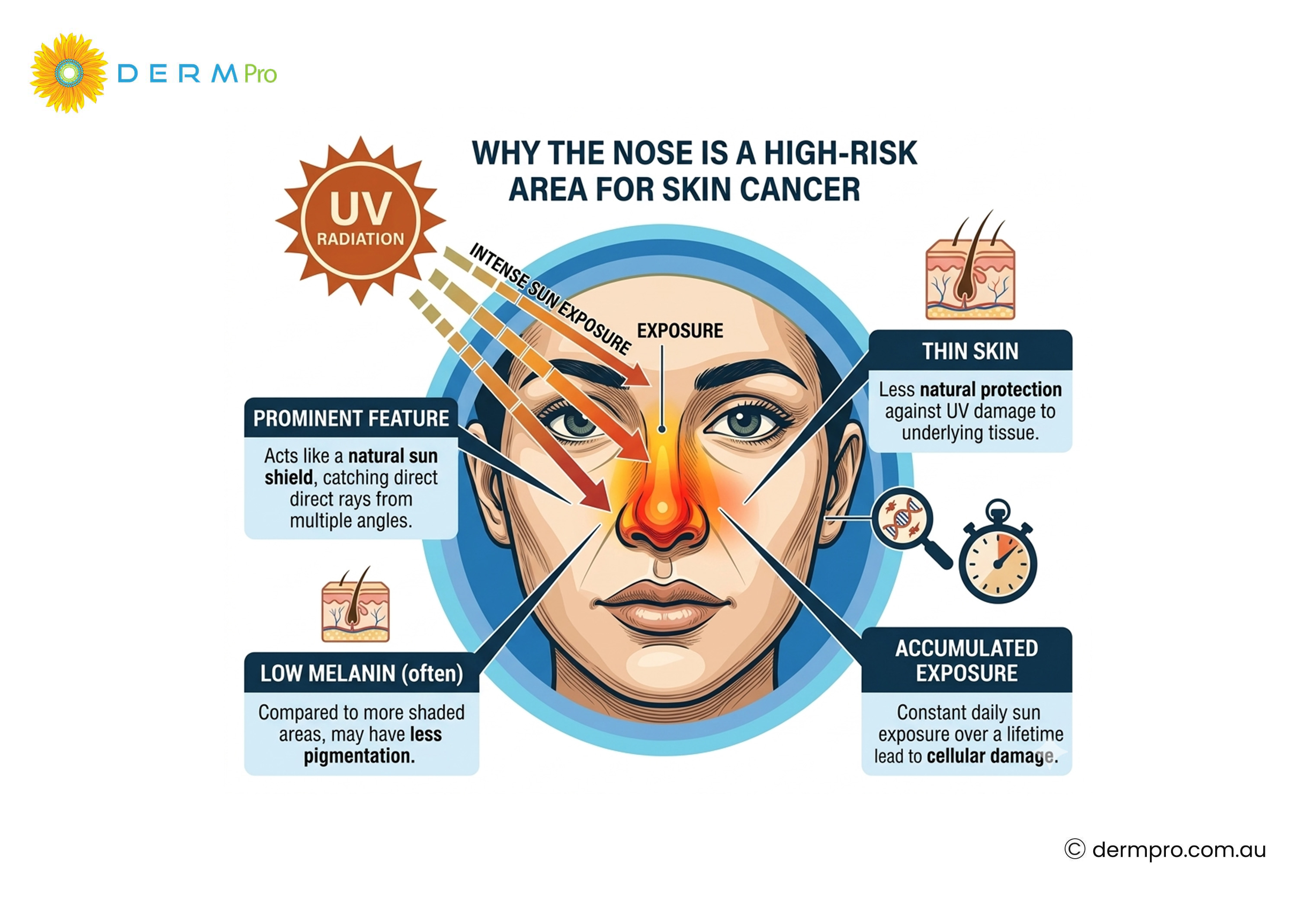 why the nose have high skin cancer risk
